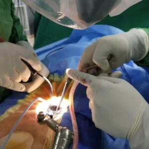 કરોડરજ્જુની સારવાર