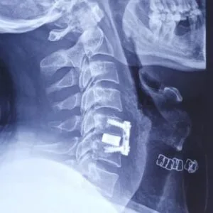Best Spine Specialist