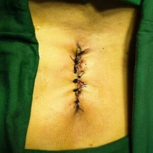 Best Spine Specialist